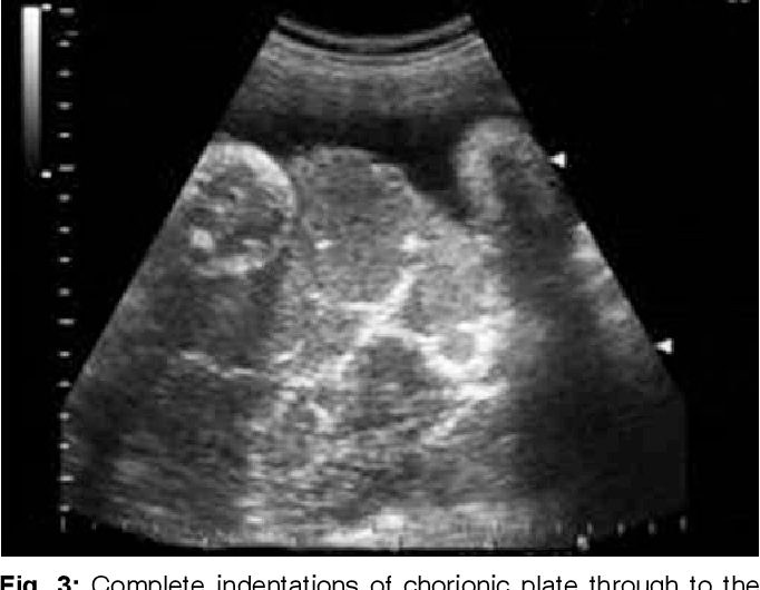 Obstetric