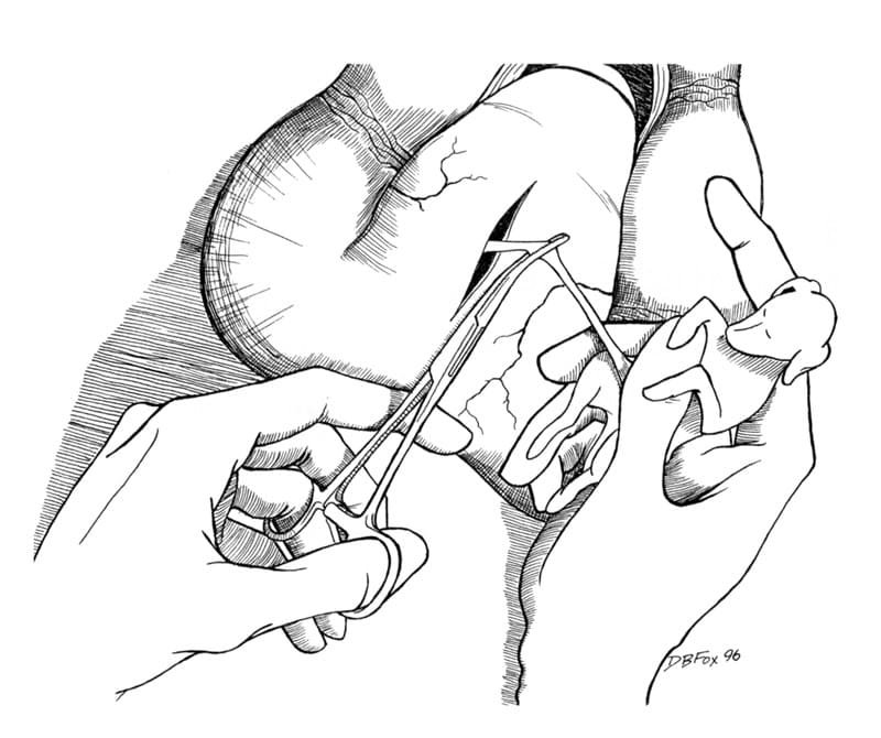 Dog Cesarean Section